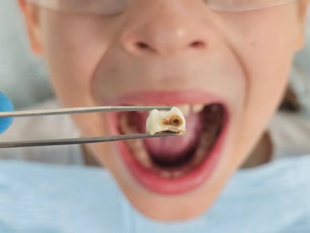 Best Emergency Pediatric Dental Care in Dickson City, PA